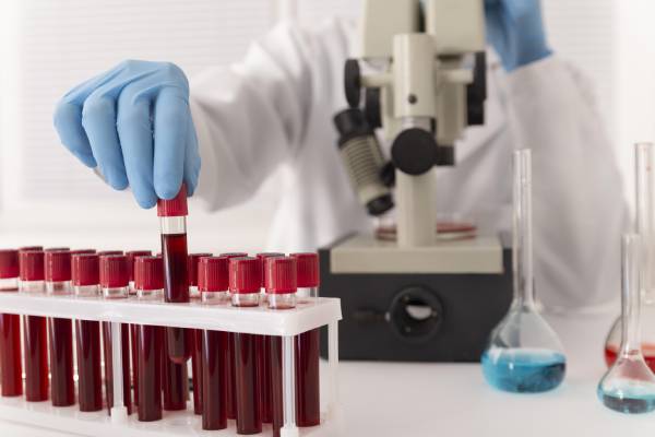 A lab technician checking blood samples to help prevent or delay the onset of type 2 diabetes.