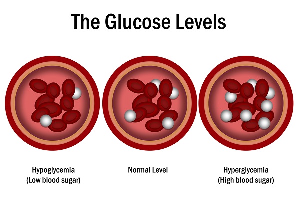 A vector diagram illustrating glucose levels in blood vessels, categorized as hypoglycemia, normal, and hyperglycemia.