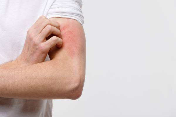 A man with a skin condition on his hand, indicating a possible weak immune system, gets tested for diabetes. 