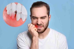 Diabetic man with oral issues like damaged teeth and swollen gums, showing the link between diabetes and oral health.