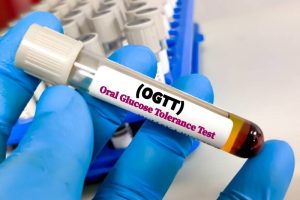 A lab technician holding an OGTT test sample, indicating signs of prediabetes.