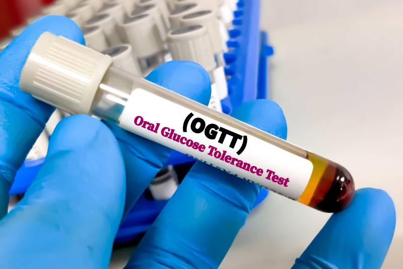 A lab technician holding an OGTT test sample, indicating signs of prediabetes.