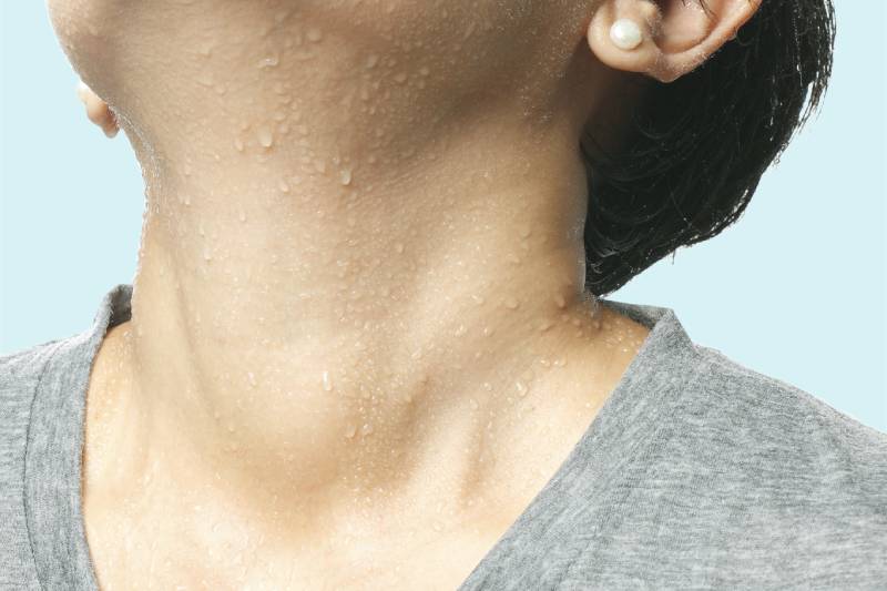 Diabetic woman sweating heavily from the neck and face, indicating hypoglycemia due to low blood sugar levels.