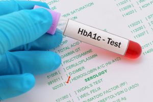 HbA1c blood samples symbolizing goal setting and diabetes management through small lifestyle changes.