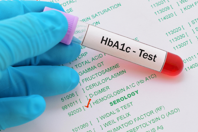 HbA1c blood samples symbolizing goal setting and diabetes management through small lifestyle changes.