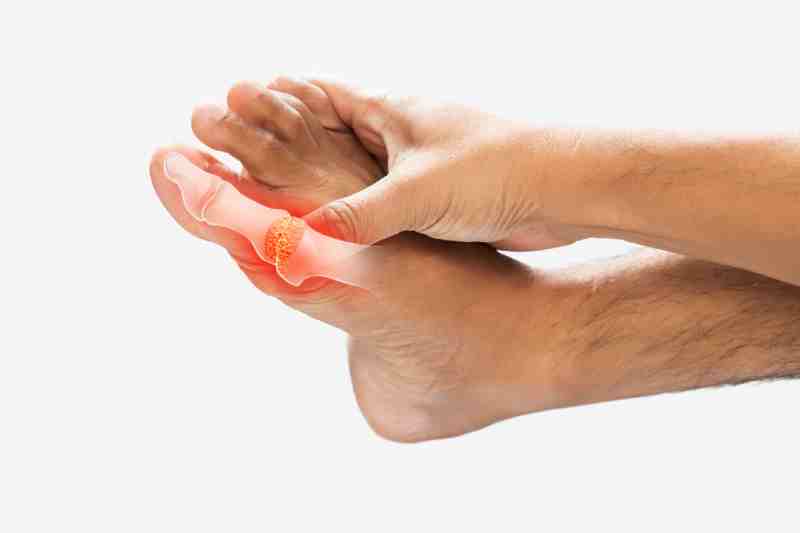 A man holding his foot in pain, illustrating diabetic nerve damage from fluctuating blood sugar harming small blood vessels.