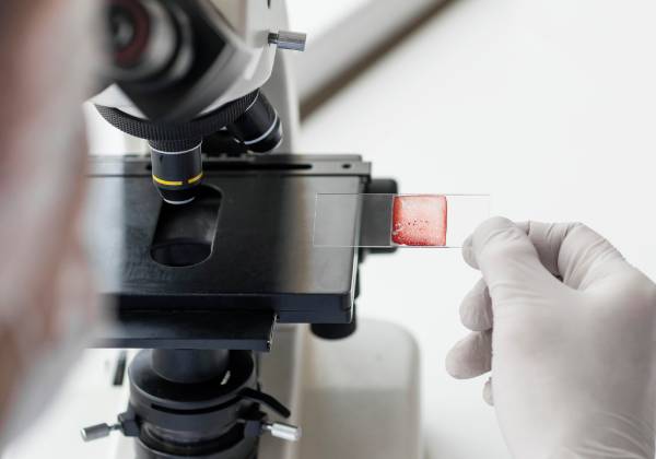 Scientist examining blood samples under a microscope to study the role of genes in diabetes.