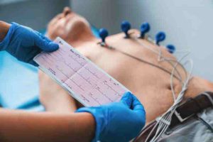 Doctor with ECG printout and patient on electrodes, showing signs of a heart attack.