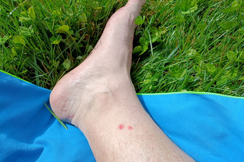 Snakebite on leg keep limb still and raised, avoid movement and seek emergency help quickly.